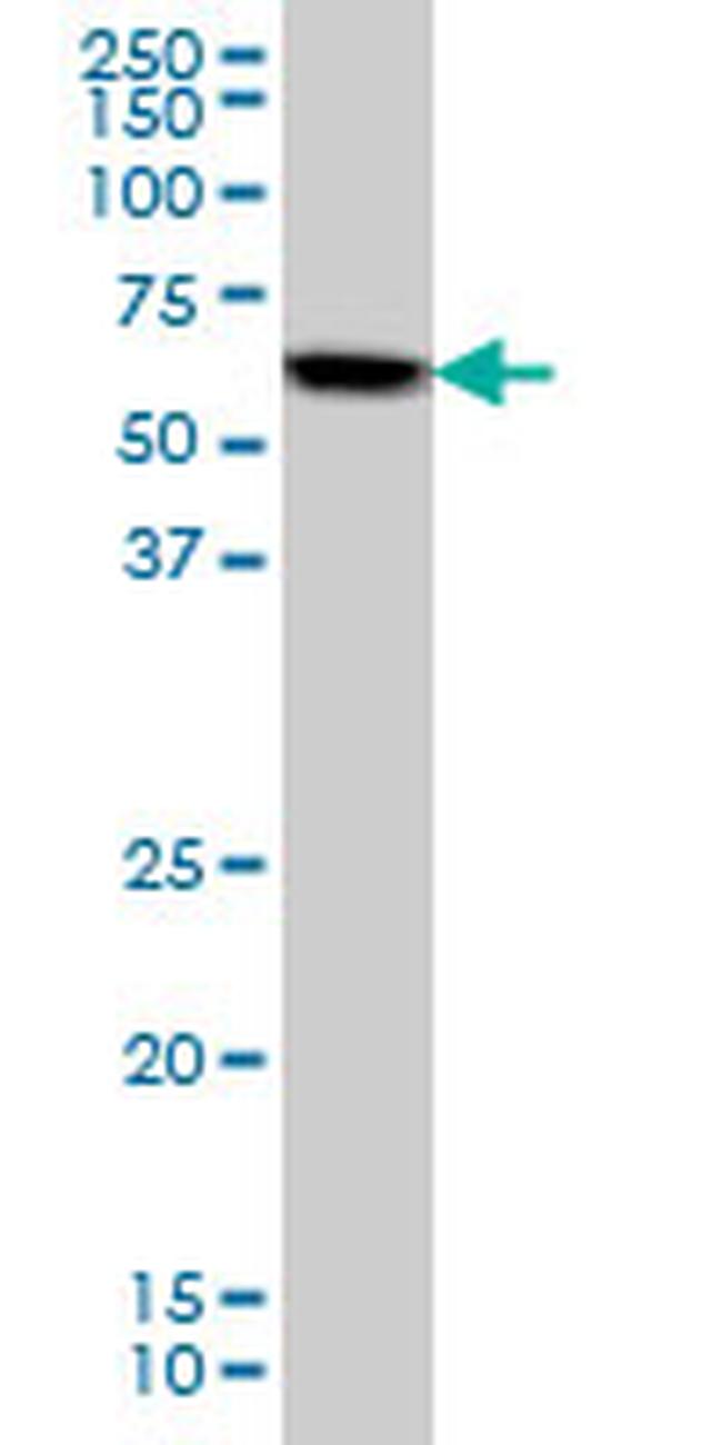 AKT1 Antibody in Western Blot (WB)