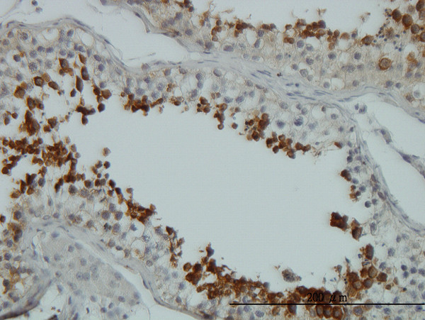 AKT1 Antibody in Immunohistochemistry (Paraffin) (IHC (P))