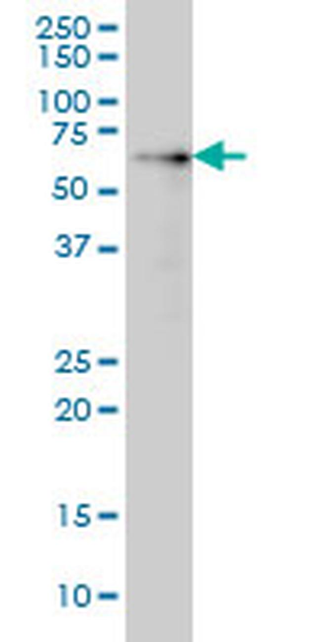 AKT1 Antibody in Western Blot (WB)