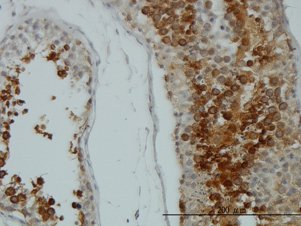 AKT1 Antibody in Immunohistochemistry (Paraffin) (IHC (P))