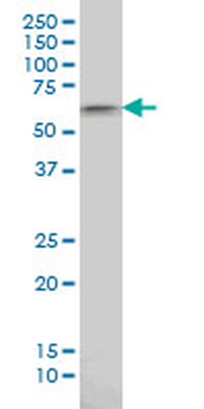 AKT1 Antibody in Western Blot (WB)