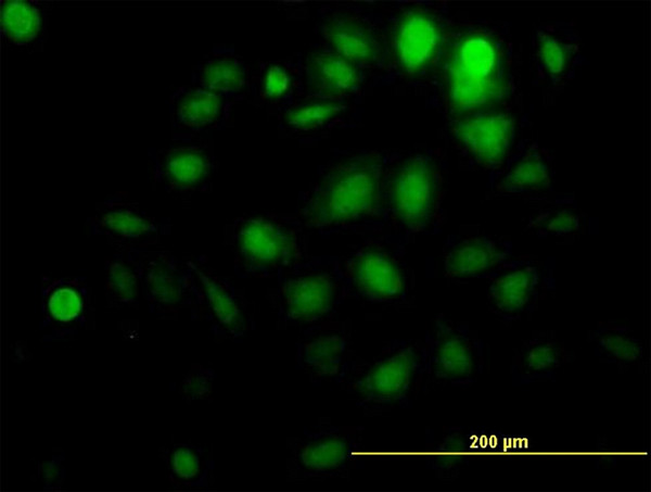 AKT1 Antibody in Immunocytochemistry (ICC/IF)