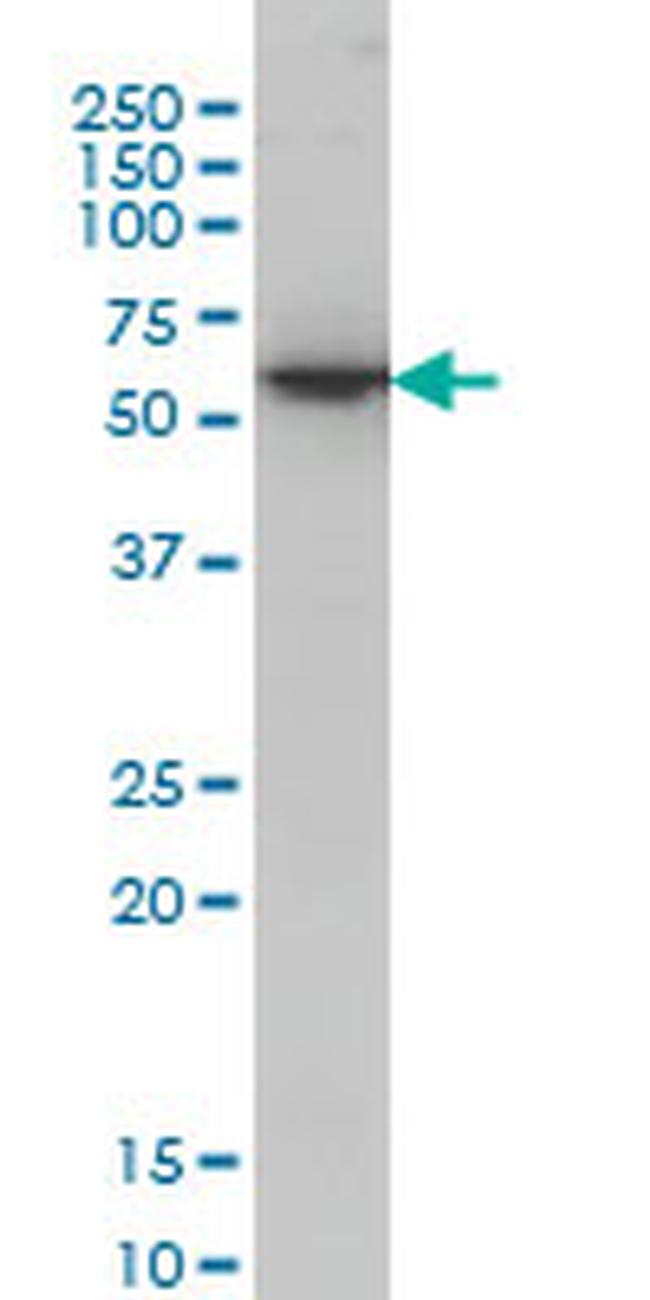 AKT1 Antibody in Western Blot (WB)