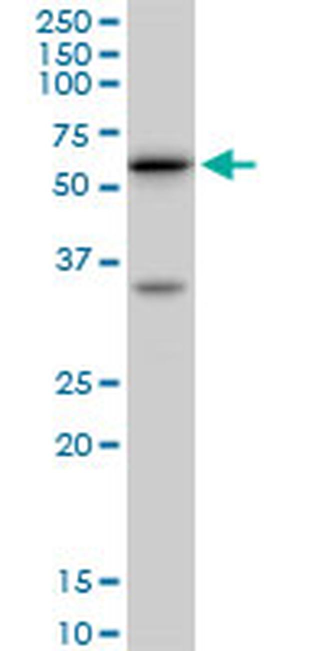 AKT1 Antibody in Western Blot (WB)