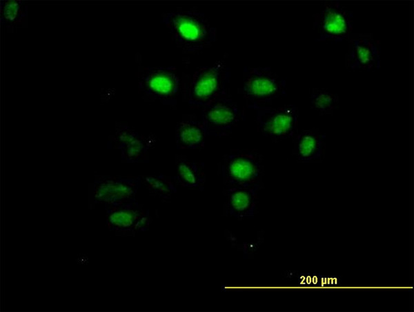 AKT1 Antibody in Immunocytochemistry (ICC/IF)