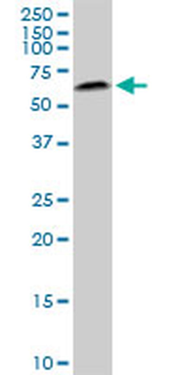 AKT2 Antibody in Western Blot (WB)