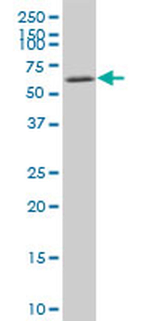 AKT2 Antibody in Western Blot (WB)