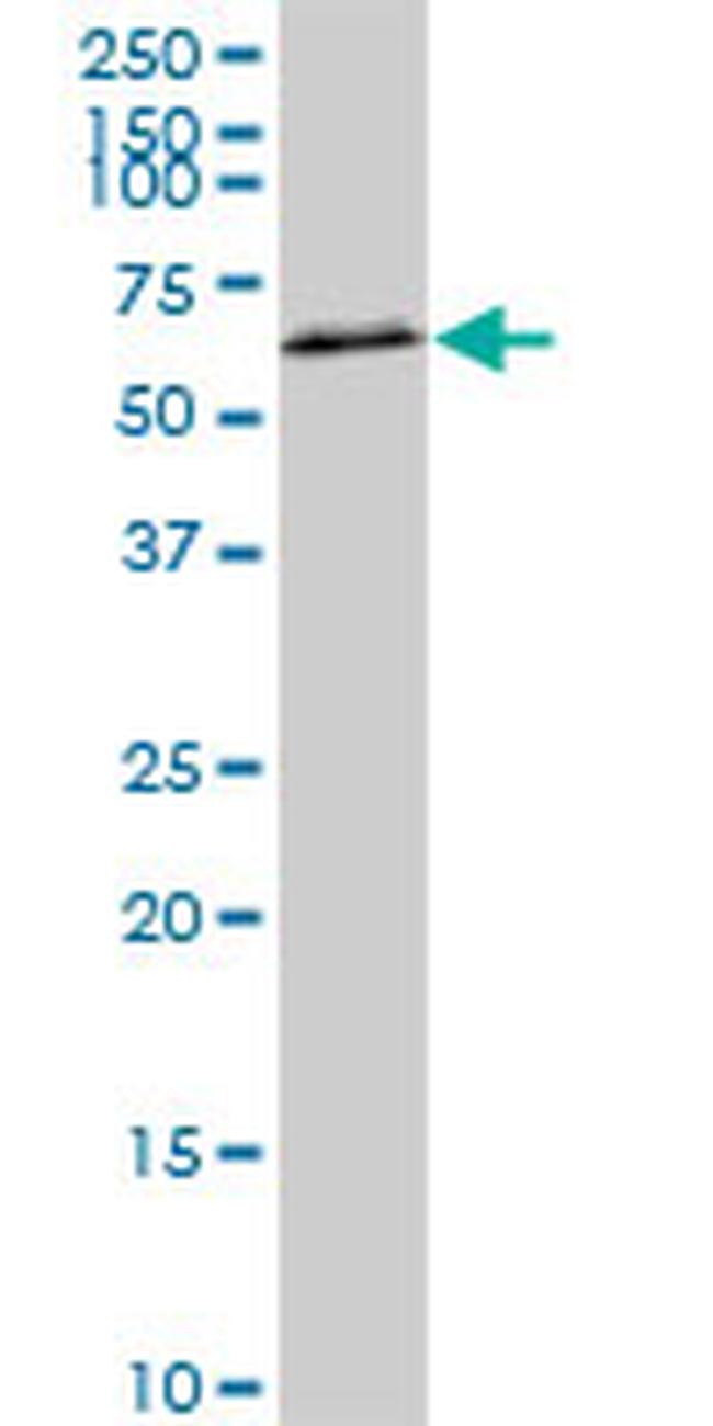 AKT2 Antibody in Western Blot (WB)