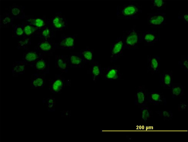 AKT2 Antibody in Immunocytochemistry (ICC/IF)