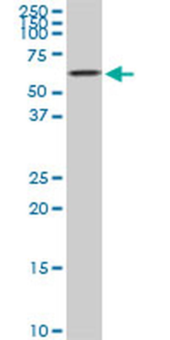 AKT2 Antibody in Western Blot (WB)