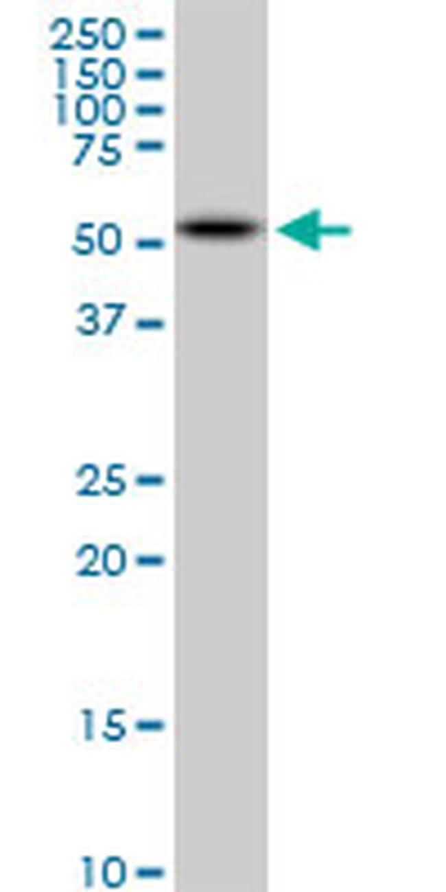 AKT2 Antibody in Western Blot (WB)