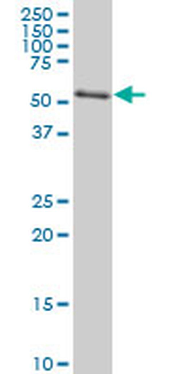 AKT2 Antibody in Western Blot (WB)