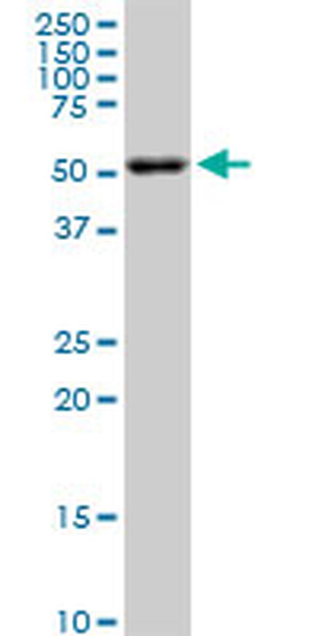 AKT2 Antibody in Western Blot (WB)