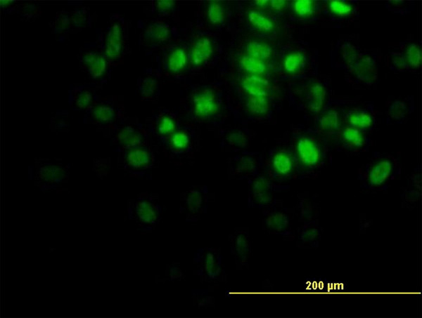 AKT2 Antibody in Immunocytochemistry (ICC/IF)