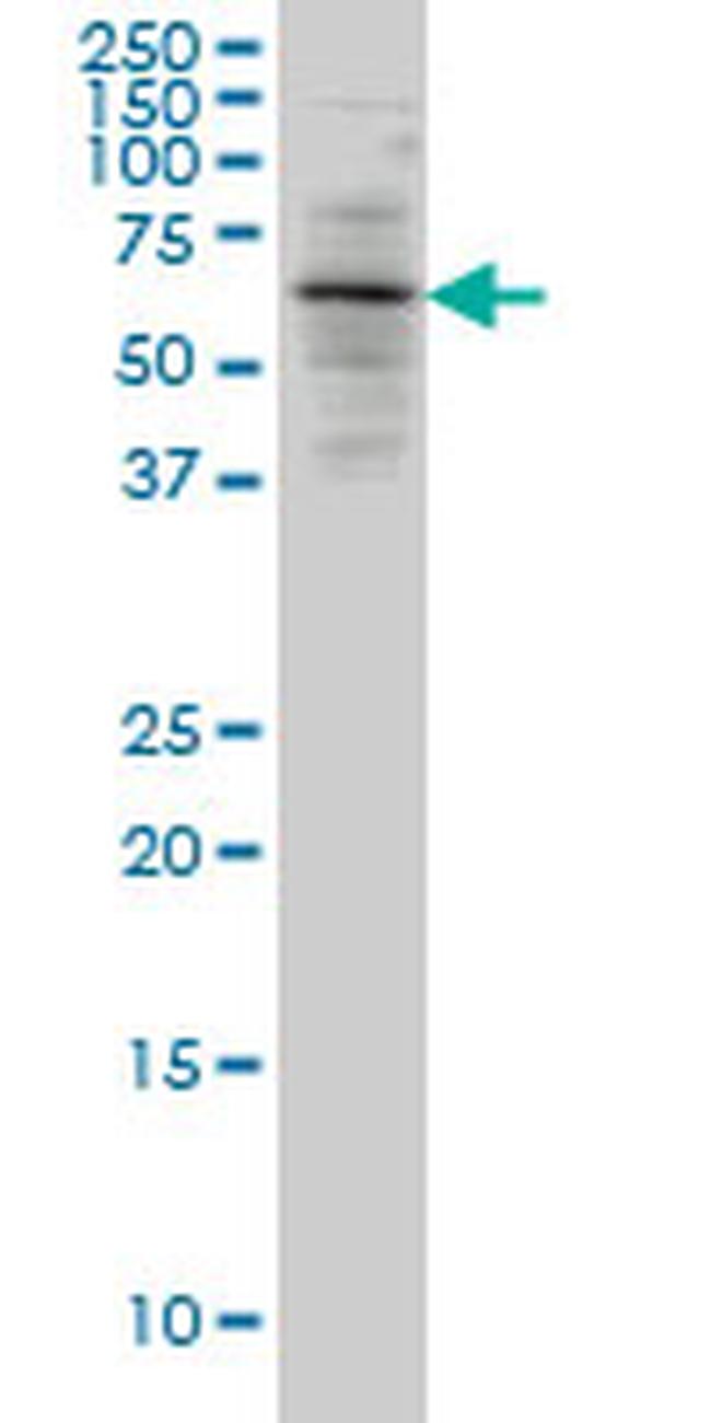 ALAS2 Antibody in Western Blot (WB)