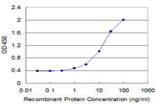 ALAS2 Antibody in ELISA (ELISA)