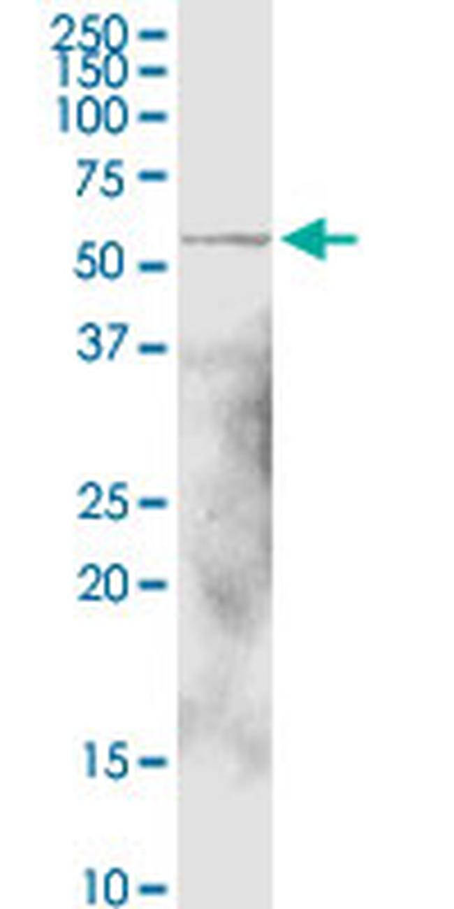 ALDH1A1 Antibody in Western Blot (WB)