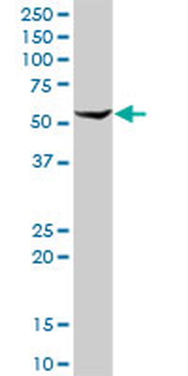 ALDH1A1 Antibody in Western Blot (WB)