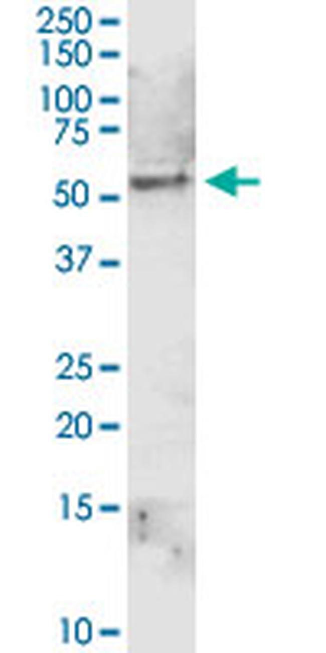 ALDH1A1 Antibody in Western Blot (WB)