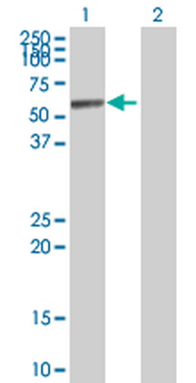 ALDH1A1 Antibody in Western Blot (WB)