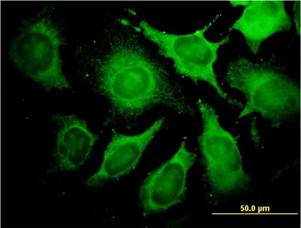 ALDOA Antibody in Immunocytochemistry (ICC/IF)