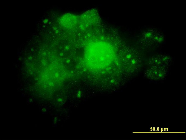 ALDOA Antibody in Immunocytochemistry (ICC/IF)