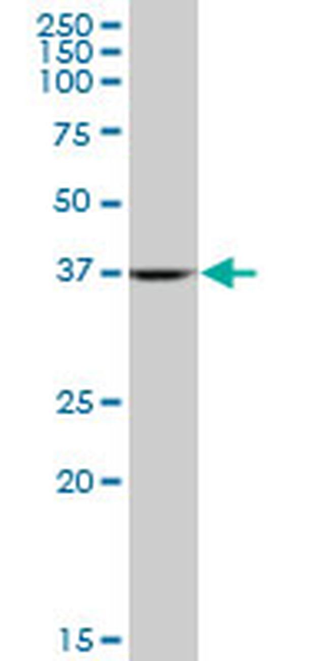 ALDOA Antibody in Western Blot (WB)