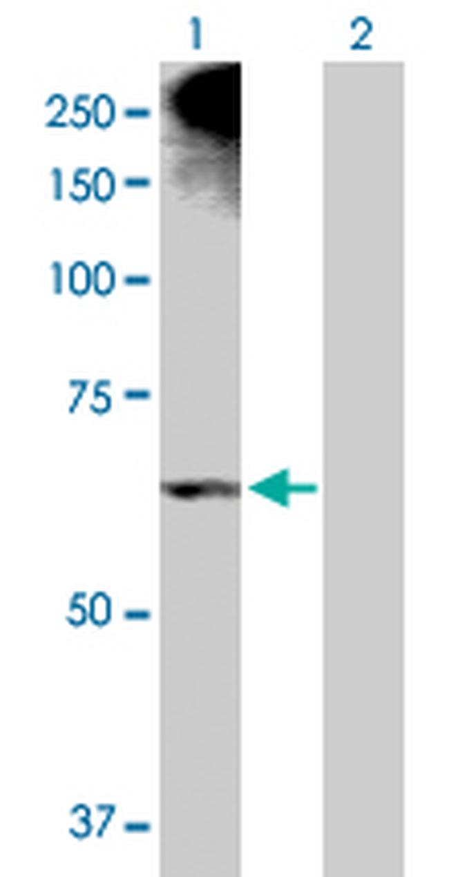 ALOX12 Antibody in Western Blot (WB)