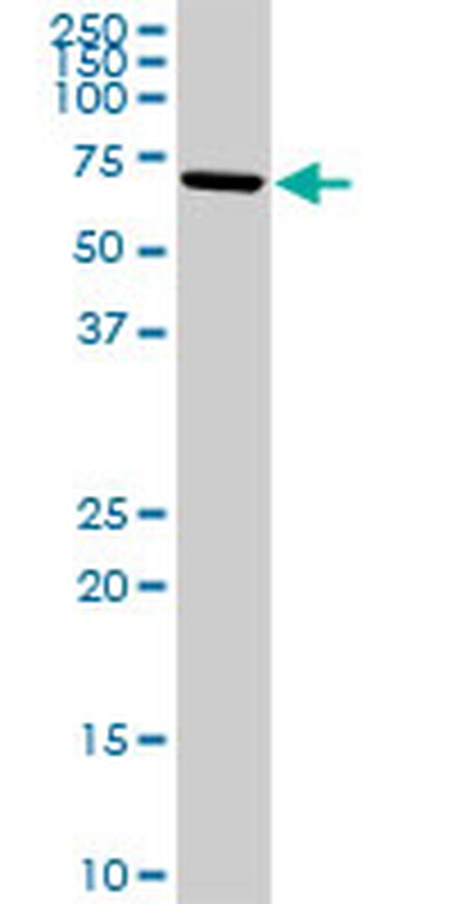 ALOX15 Antibody in Western Blot (WB)