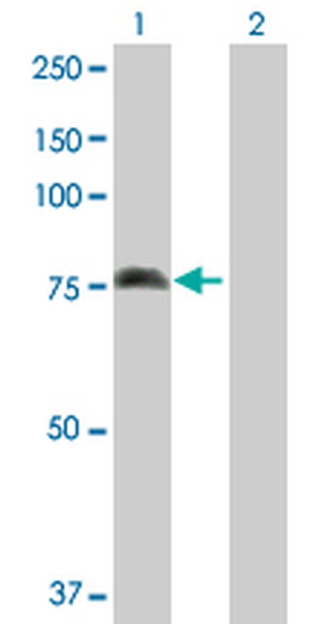 ALOX15 Antibody in Western Blot (WB)