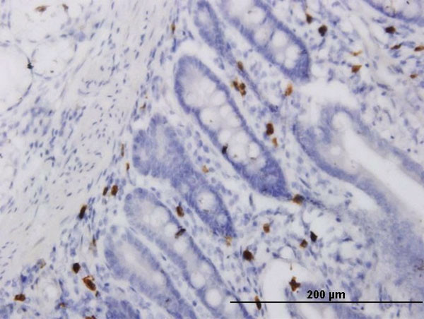 ALOX15 Antibody in Immunohistochemistry (Paraffin) (IHC (P))