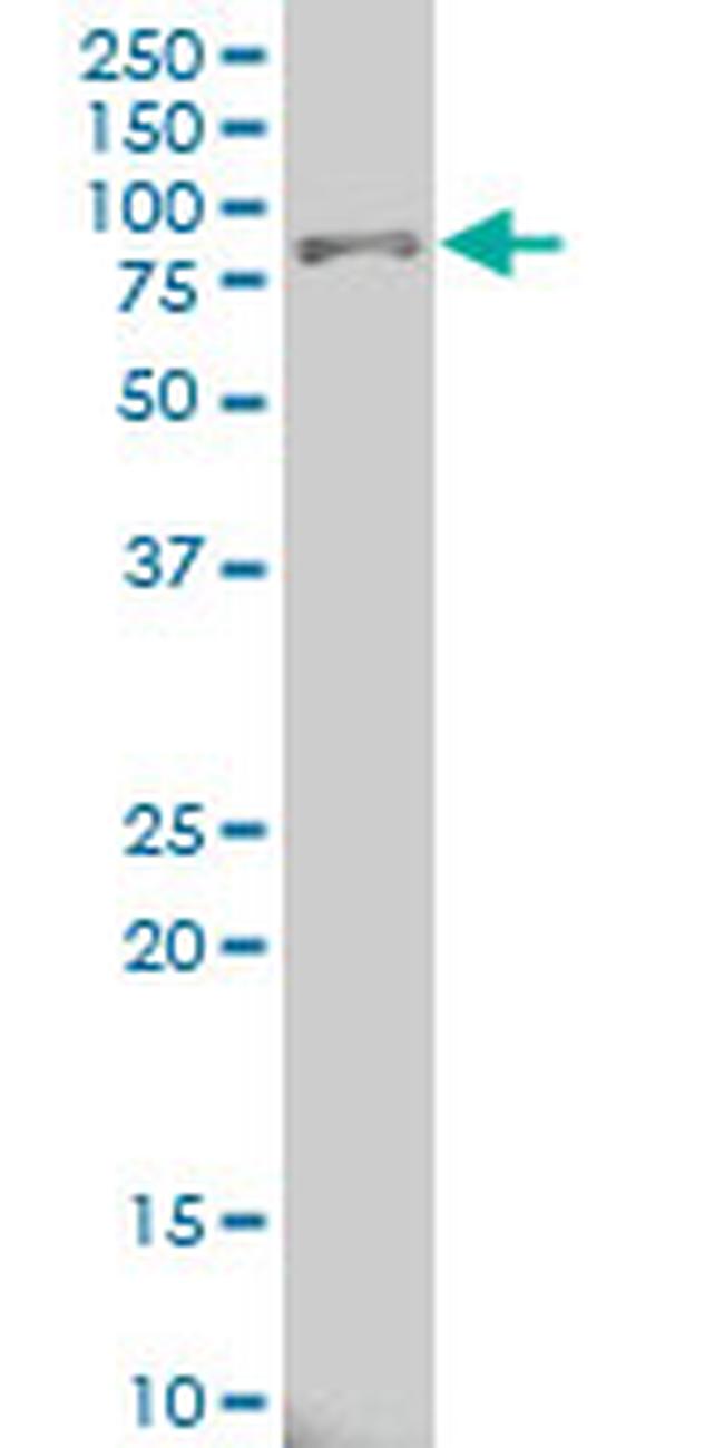 ALOX15 Antibody in Western Blot (WB)