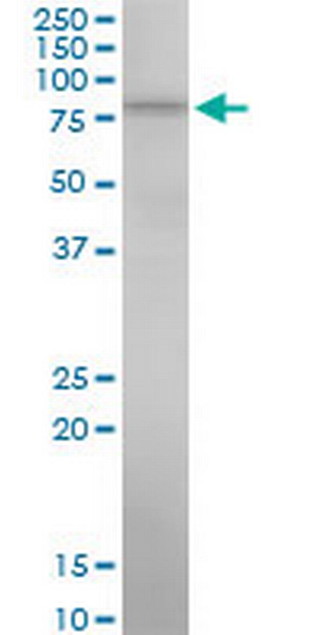 ALOX15 Antibody in Western Blot (WB)