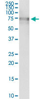 ALPL Antibody in Immunoprecipitation (IP)