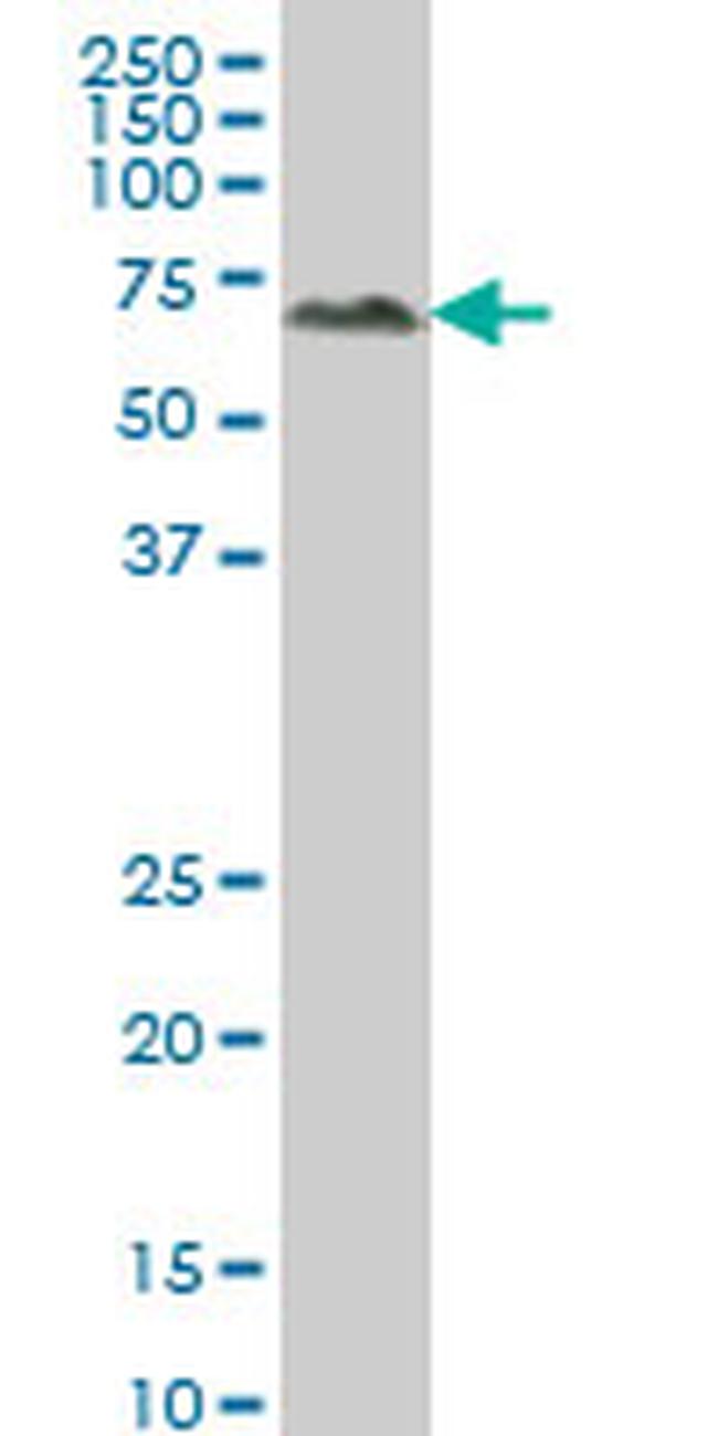 ALPPL2 Antibody in Western Blot (WB)