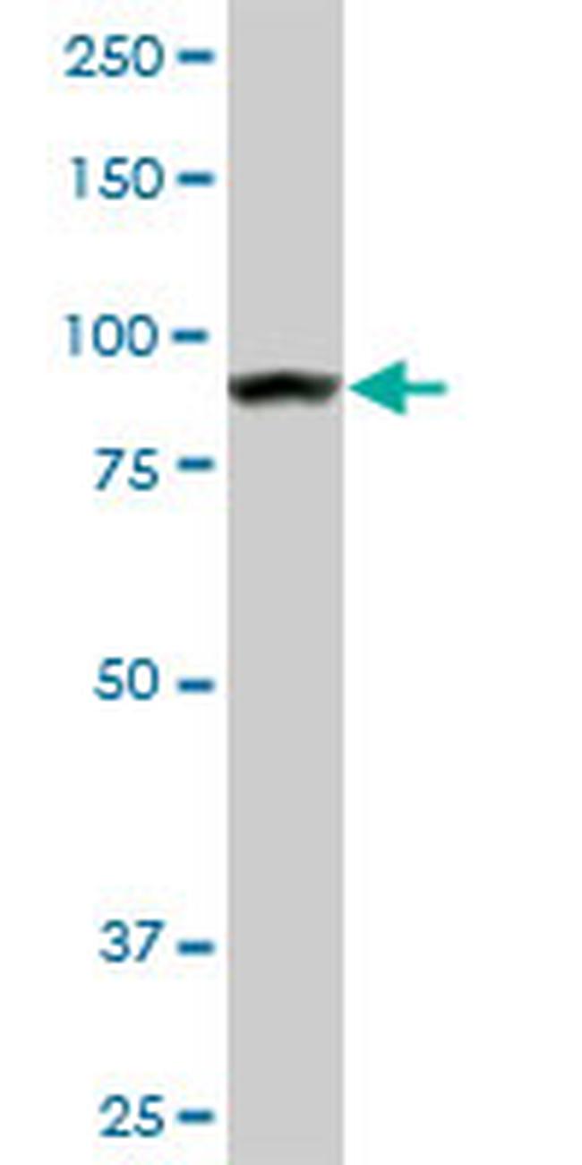 AMPD2 Antibody in Western Blot (WB)