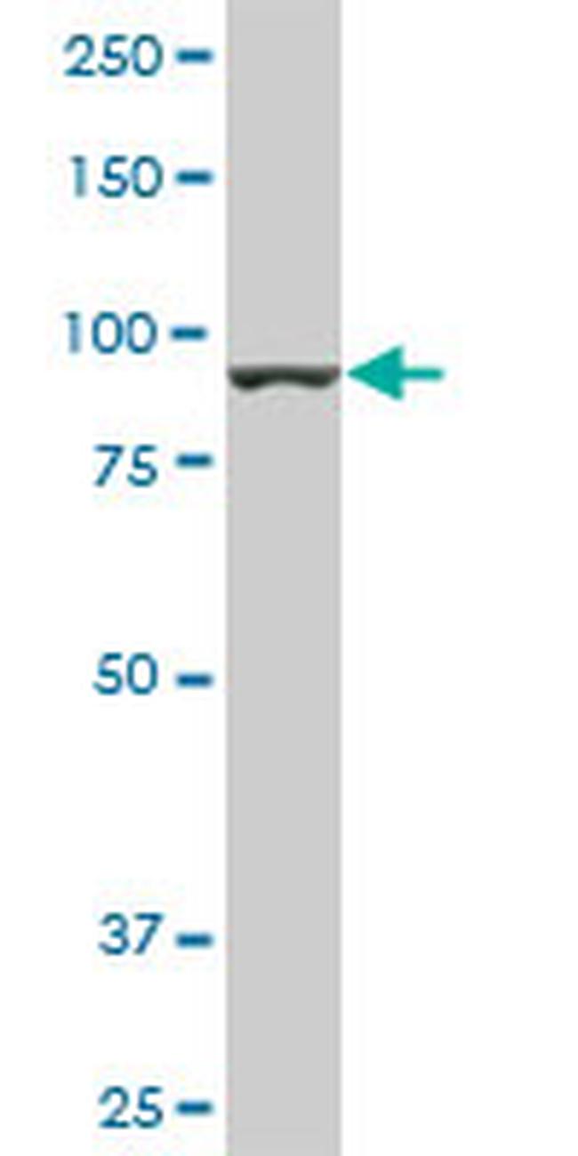 AMPD2 Antibody in Western Blot (WB)