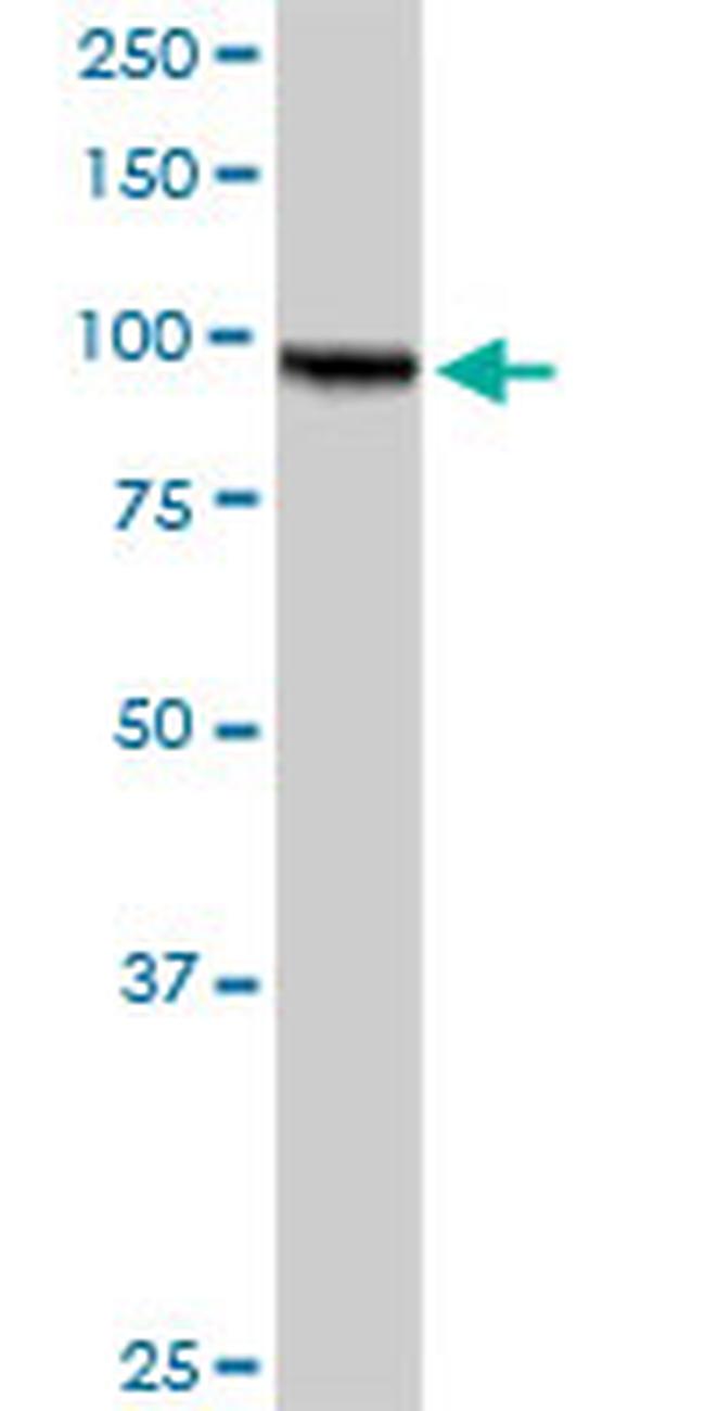 AMPD2 Antibody in Western Blot (WB)