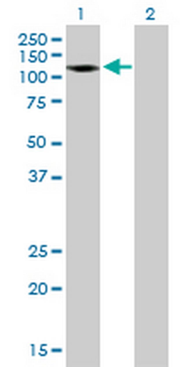 AMPH Antibody in Western Blot (WB)