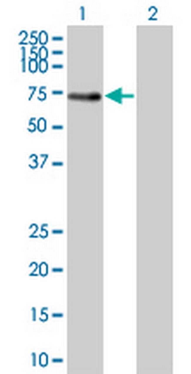 BIN1 Antibody in Western Blot (WB)