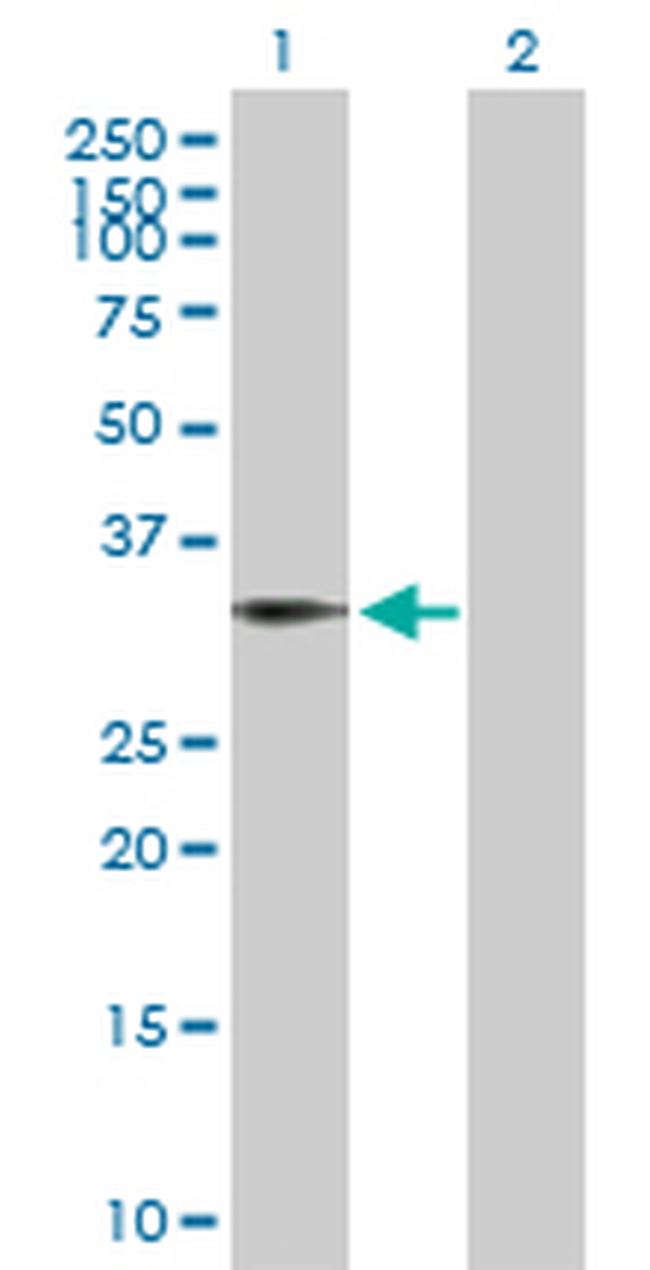 BIN1 Antibody in Western Blot (WB)