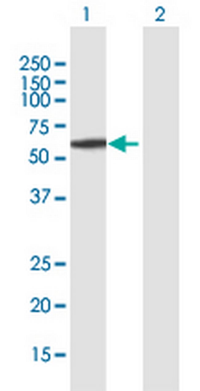 AMY2A Antibody in Western Blot (WB)