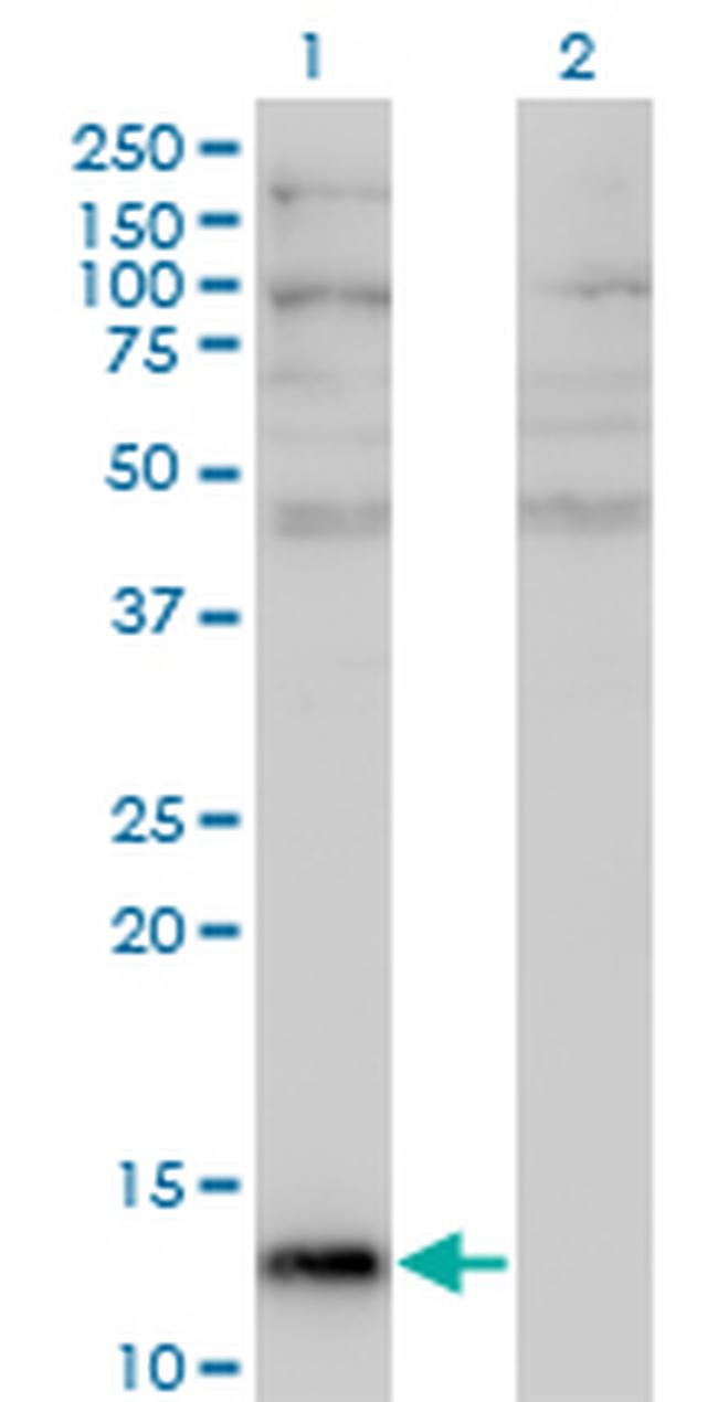 ANG Antibody in Western Blot (WB)