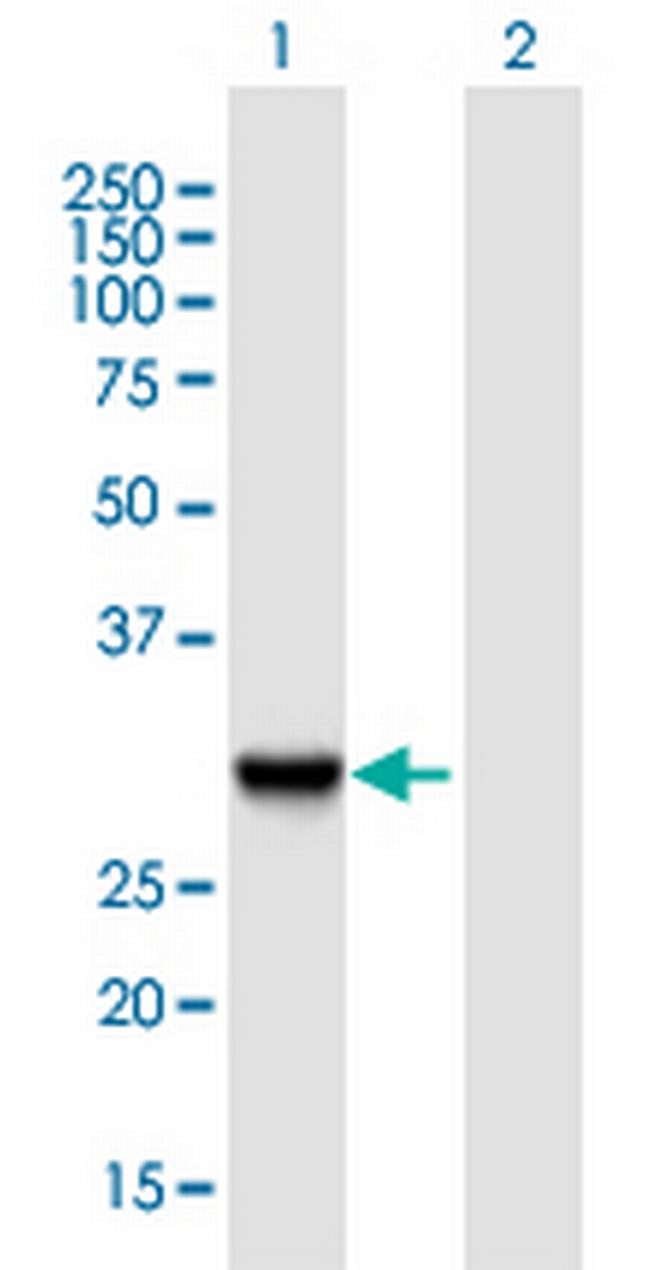 SLC25A5 Antibody in Western Blot (WB)