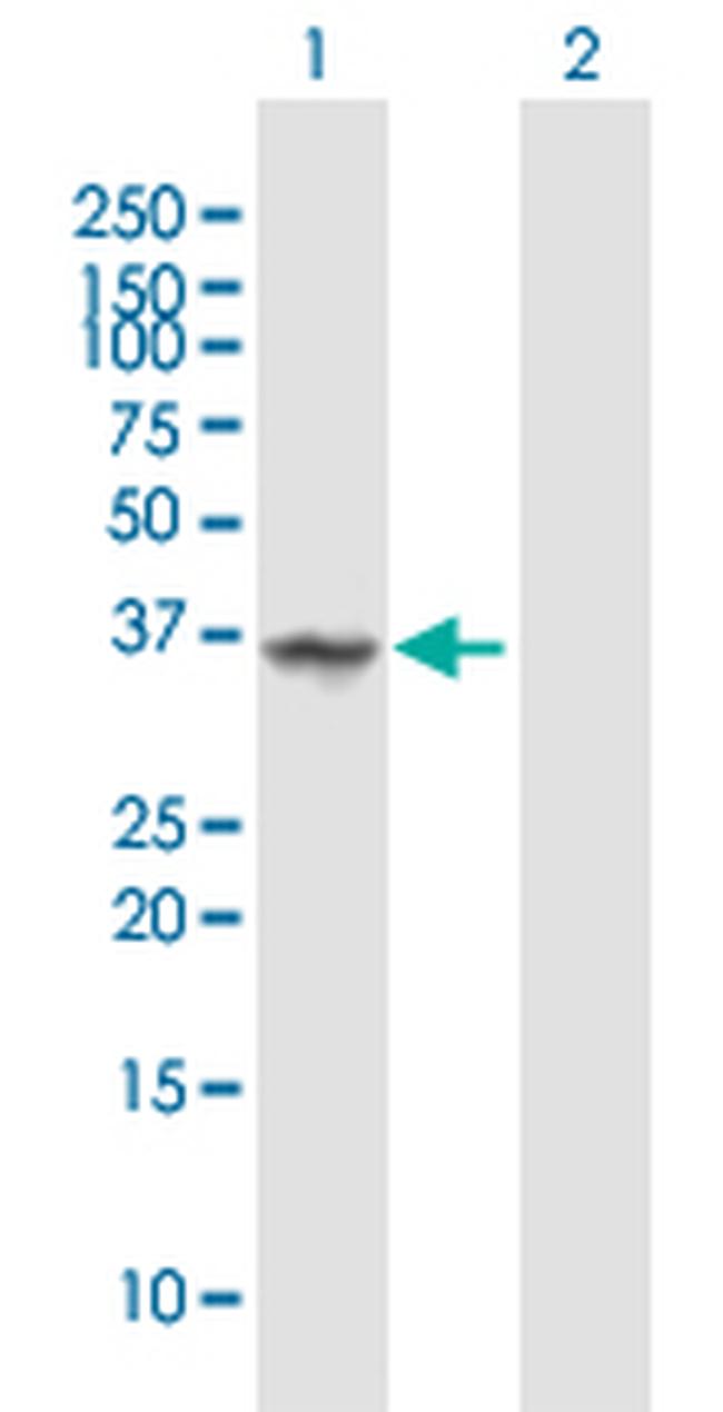 ANXA1 Antibody in Western Blot (WB)