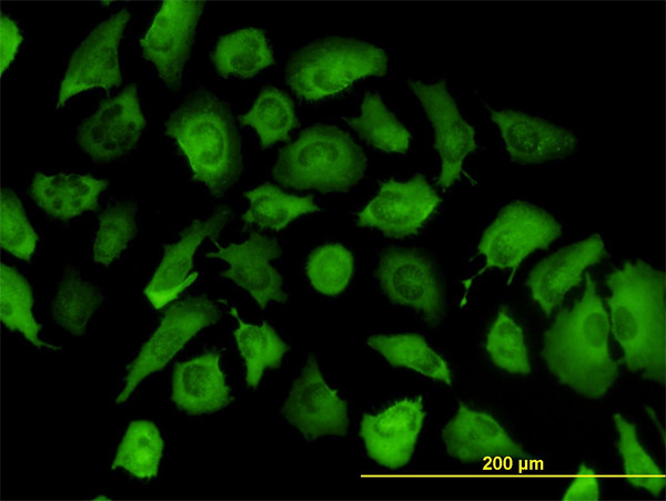 ANXA2 Antibody in Immunocytochemistry (ICC/IF)