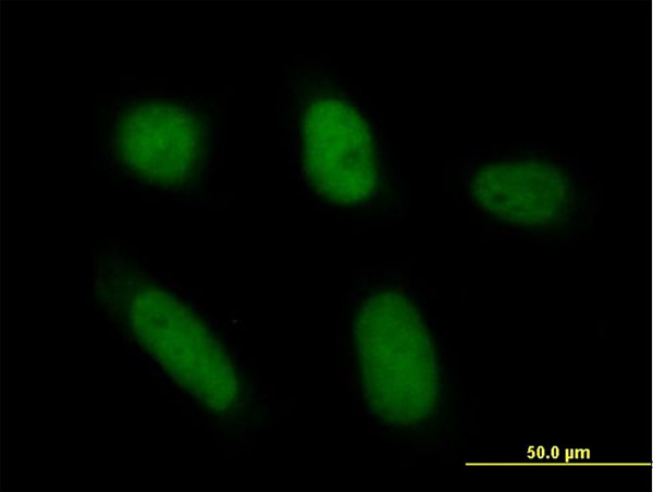 ANXA5 Antibody in Immunocytochemistry (ICC/IF)