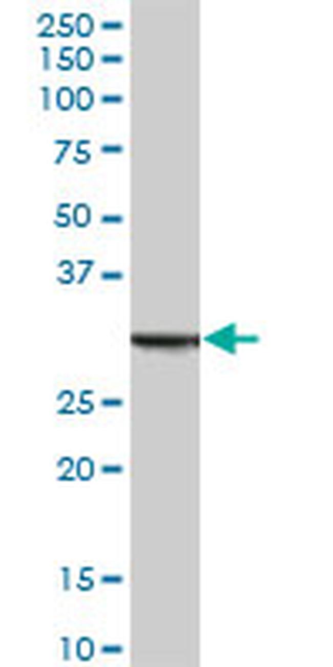 ANXA5 Antibody in Western Blot (WB)