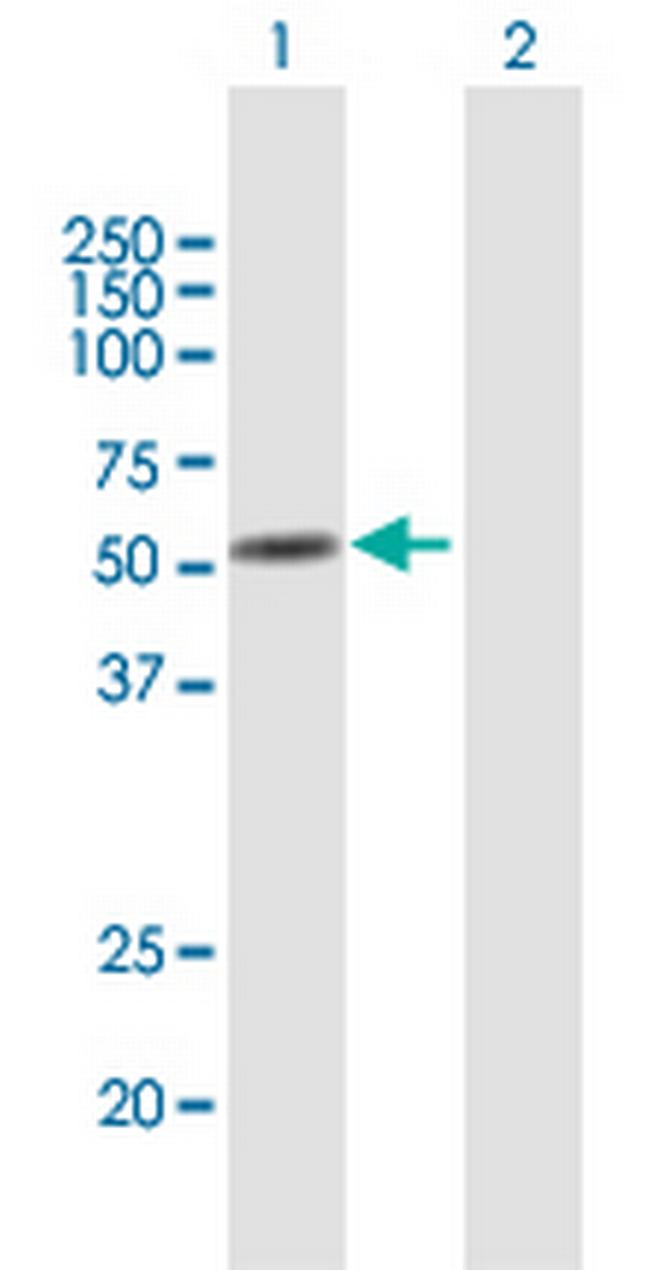 ANXA11 Antibody in Western Blot (WB)