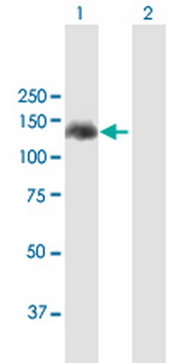 APAF1 Antibody in Western Blot (WB)